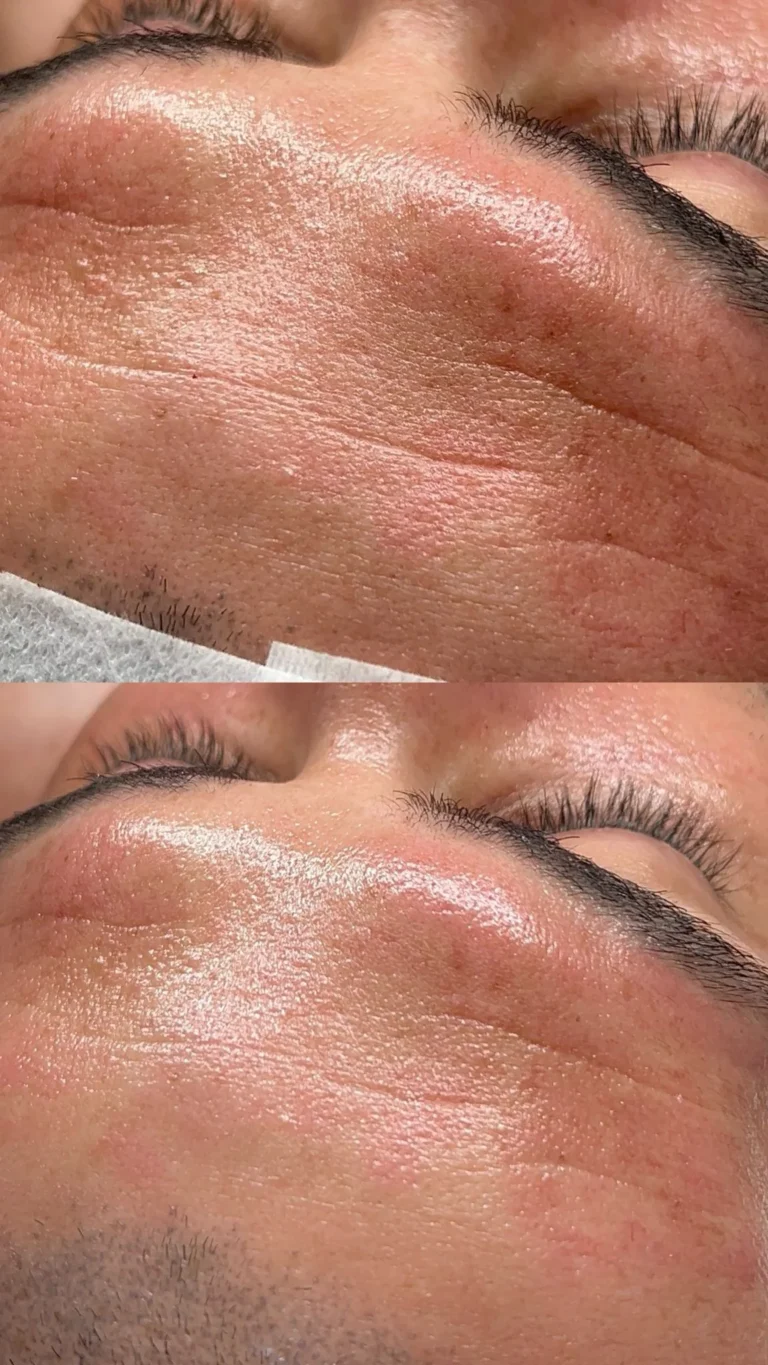 Clínica de estética - Facial