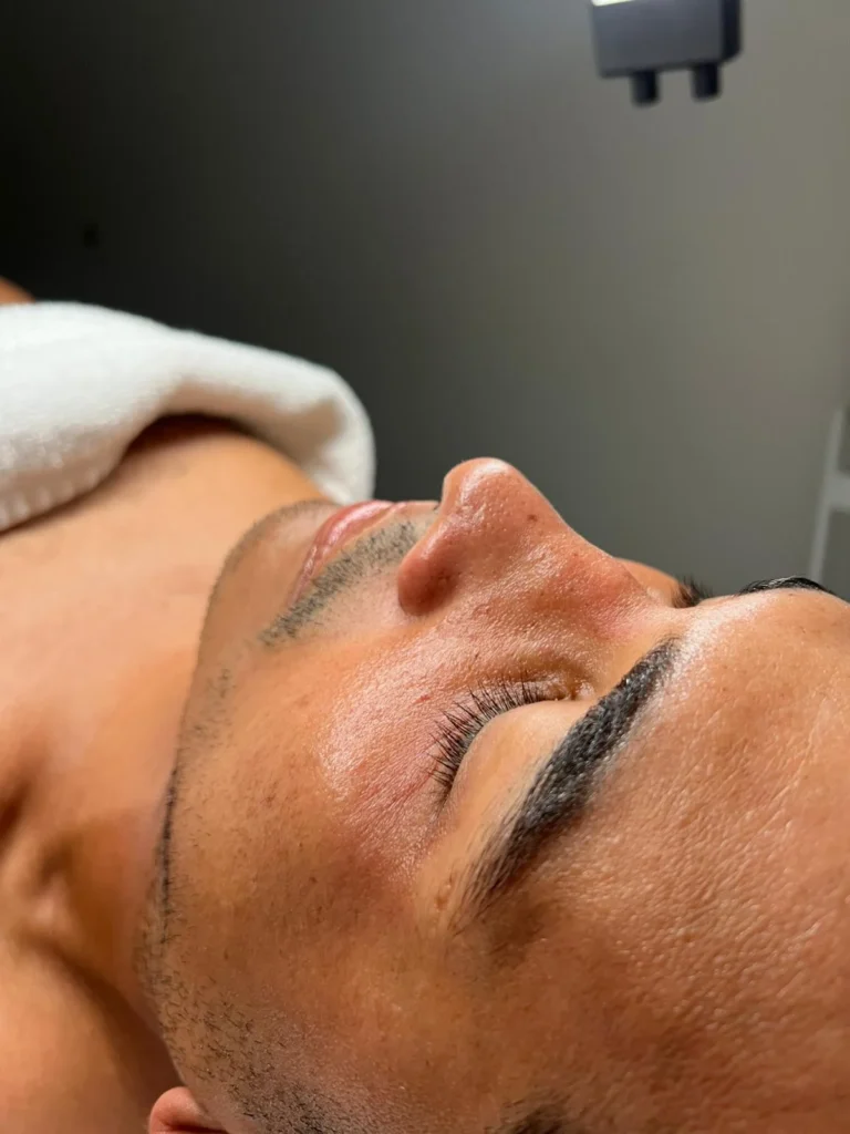 Clínica de estética - Facial