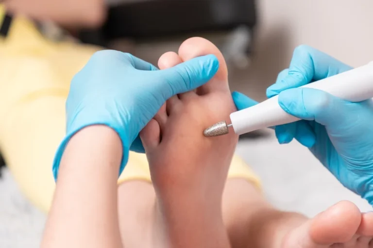 Clínica de estética - Pedicura
