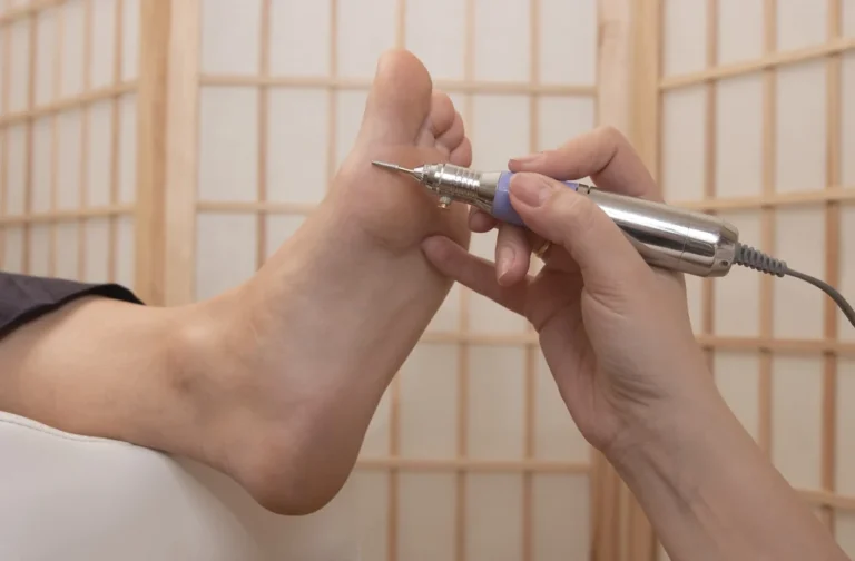 Clínica de estética - Pedicura